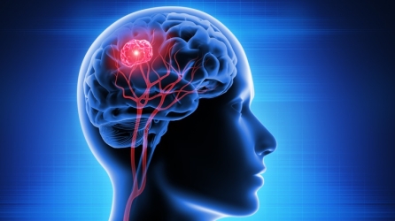 Monaco Scientific Centre Makes a Breakthrough in Brain Cancer Treatment